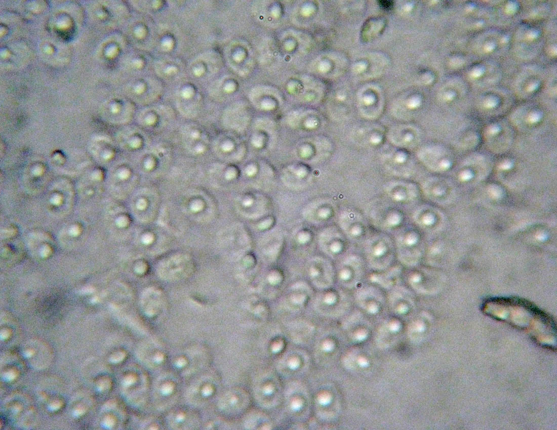 Steccherinum?